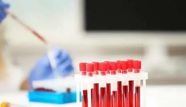分支機構丨腎臟病透析與互聯網醫療