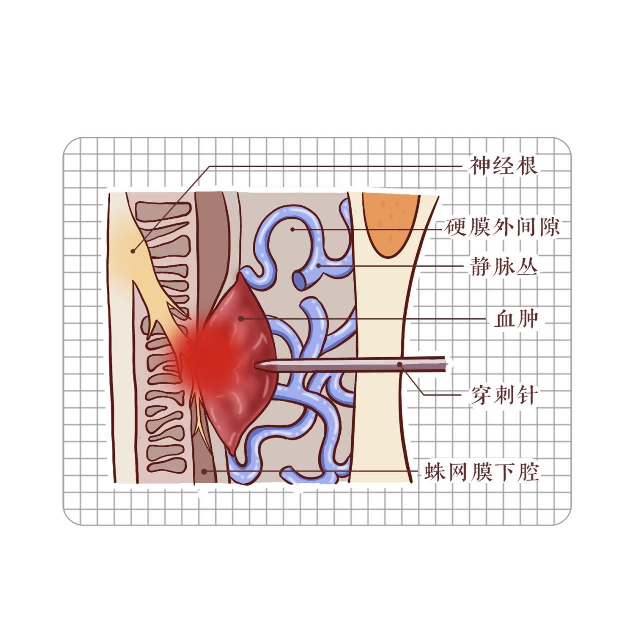图片5.jpg